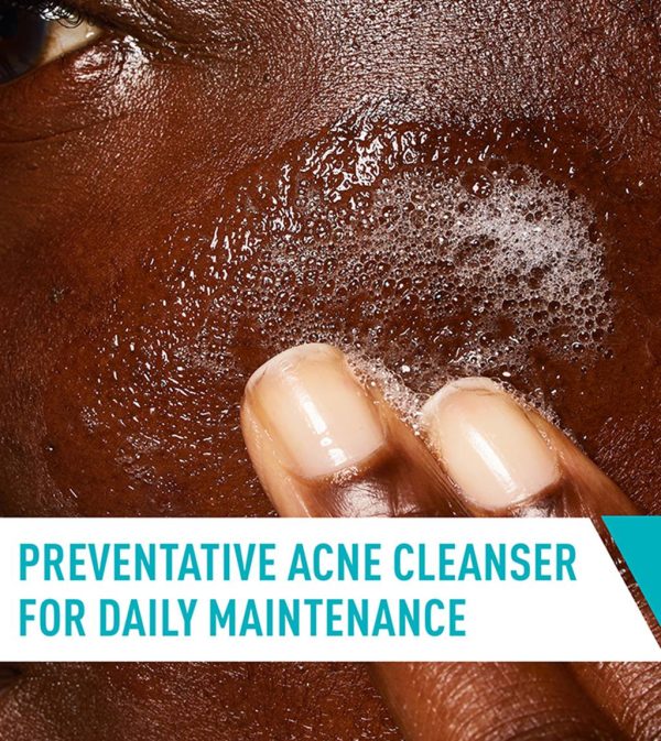 Acne Control Cleanser - Image 4