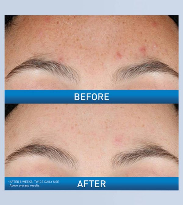 Resurfacing Retinol Serum - Image 3